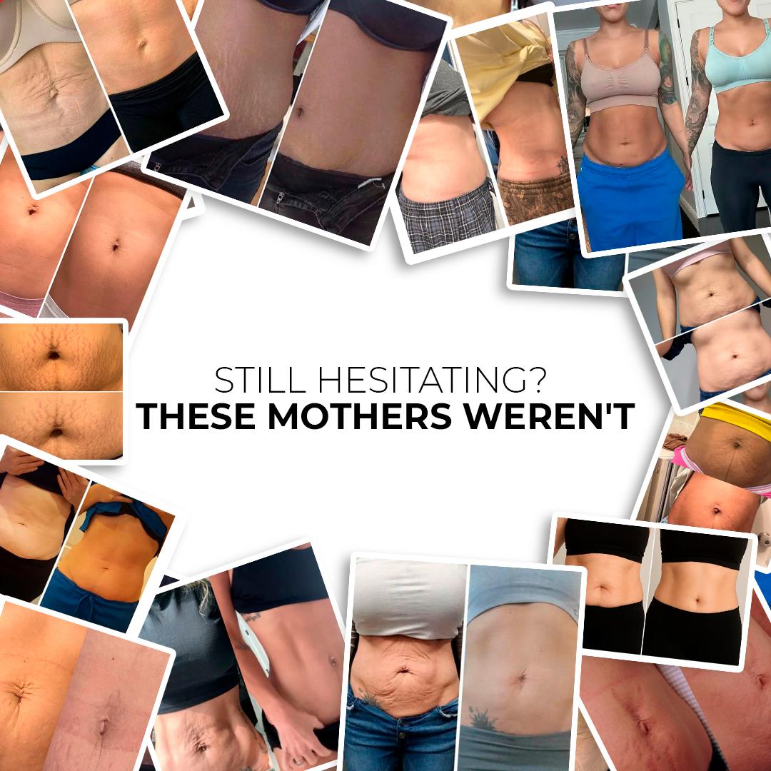 Lustra™ | Flatten That Stubborn Belly Skin