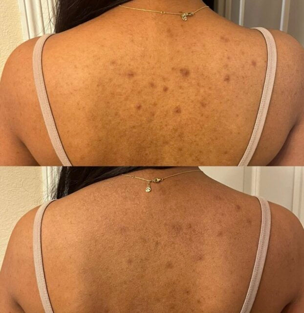 AuroraGlow™ | BUY 2 GET 1 FREE