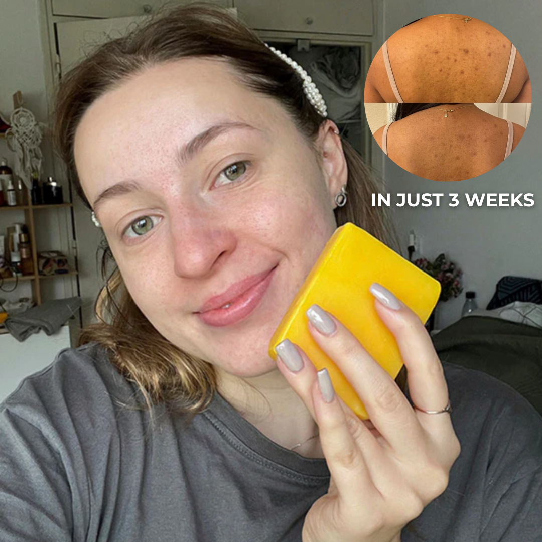 AuroraGlow™ | BUY 2 GET 1 FREE