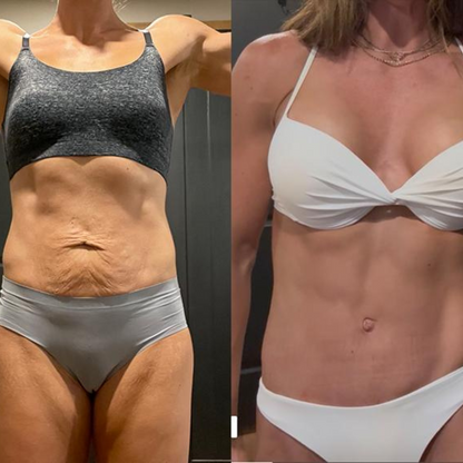 Lustra™ | Flatten That Stubborn Belly Skin