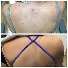 AuroraGlow™ | BUY 2 GET 1 FREE